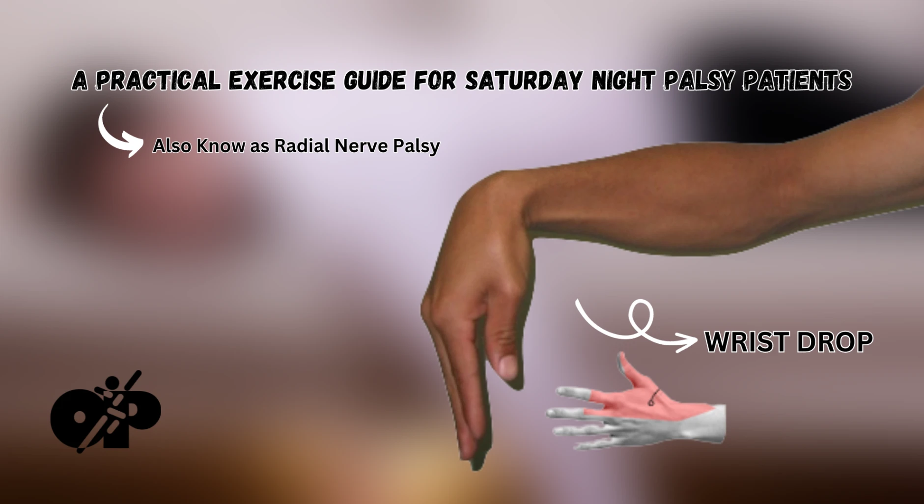 39. A Practical Exercise Guide for Saturday Night Palsy Patients