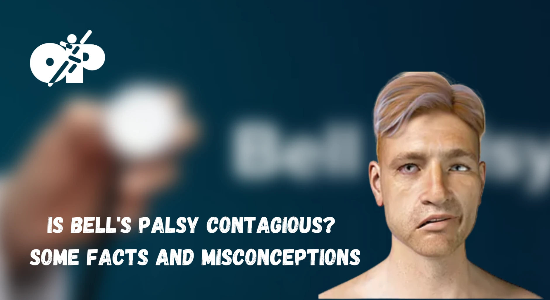 38. Is Bell’s Palsy Contagious Some Facts and Misconceptions
